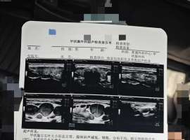 癌我别怕-记录治疗过程