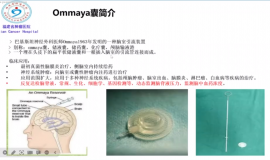 神奇的ommaya囊——学习笔记