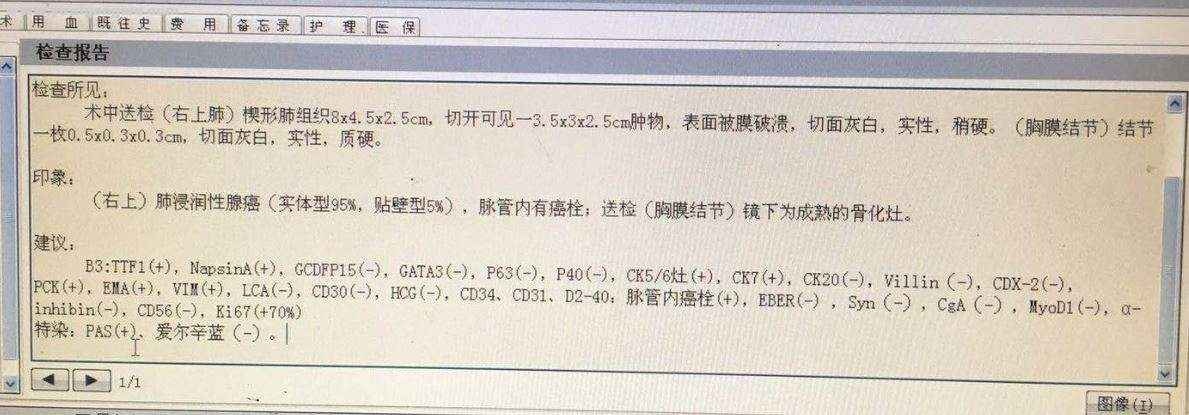 检查报告